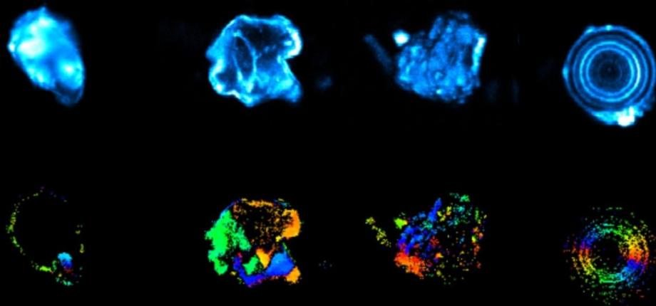 Imagerie multiphoton des calculs rénaux