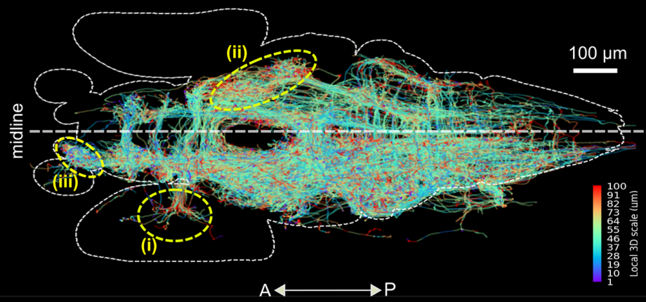 Large-volume bioimage informatics