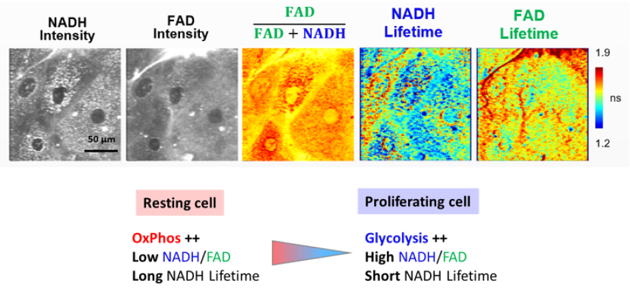 FLIM-based metabolic imaging